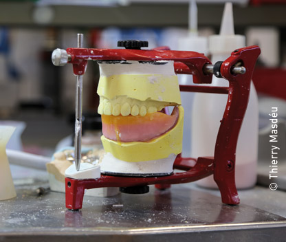 Production laboratoire de prothèses dentaires